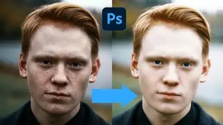 Fastest Way to Clean Your Face in Adobe Photoshop| Remove Pimples Easily#photoshopcc #viral