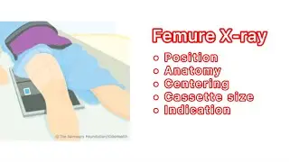 Femur or thigh bone x ray In Hindi | S C Paramedical institute