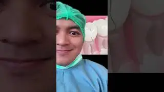 Aku yakin es nya itu rasanya enak tapi yang bikin khawatir itu cara makannya 🥹