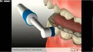 Preventive - Brushing With Electric Tooth Brush - Dentist In Ottawa