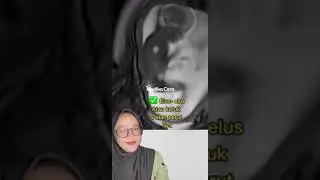 Peek at fetal movement in the womb before giving birth - Medikacare