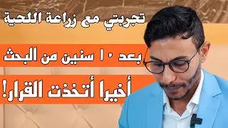 بعد 10 سنوات من الإنتظار أخيرا أتخذت القرار! تجربتي مع زراعة اللحية بعد 15 يوم