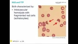 Hemolytic Anaemia : Part 2: Chapter 5