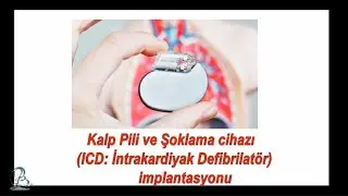 kalp pili ICD implantasyonu Gerçek vaka