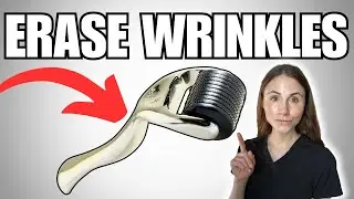 Erase Wrinkles, Stretch Marks, And More | Microneedling Explained