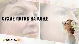 Сухие пятна на коже