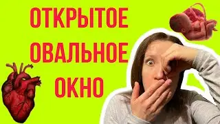 ОТКРЫТОЕ ОВАЛЬНОЕ ОКНО У РЕБЁНКА НА ЭХО-КГ: это страшно?!