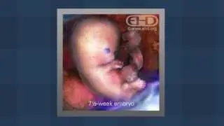See Baby — An Introduction to EHD's Pregnancy Resources