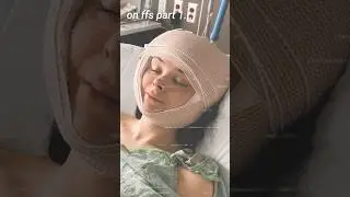 My Facial Feminization Surgery... Male to Female Transgender Transition Update