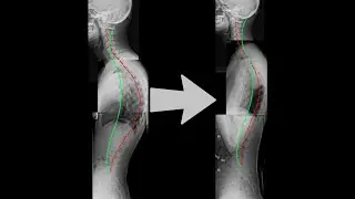 Posture + Spine Enhancer