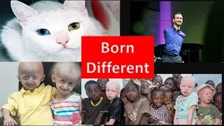 Born Different with rare conditions
