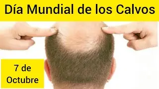 Felicidades a todos los calvos en el 