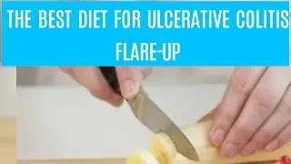 The best diet for ulcerative colitis flare-up