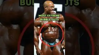 5 MOST EXTREME BUBBLE GUTS 