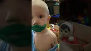 красивый Толя. весь в зелёнке.