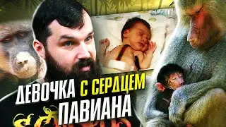 Пересадка сердца павиана? Трагическая история Бэби Фэй