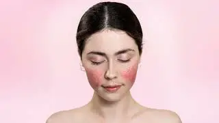 How to fix red skin with Photoshop in less than a minute