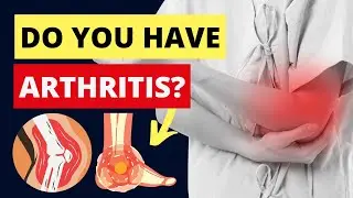 Foods to Avoid If You Have Rheumatoid Arthritis