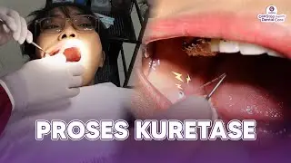 PROSES KURATASE DIAPAIN AJA SIH?