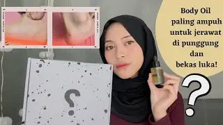 Body Oil DSAVIOR! Produk untuk menyamarkan bekas luka dan jerawat di punggung! Noda hitam di badan?