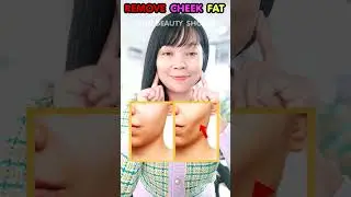 ONLY 1 EXERCISE Remove Buccal Fat, Loss Cheek Fat, Slim Face Fast #buccalfatremoval #slimface