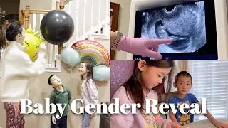 First Ultrasound | Telling Our Kids I'M Pregnant | Gender Reveal