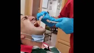 Gömük , Kırık 20  Yaş Diş Çekimi | Korkulacak bir İşlem Değildir ; Rahat Olunuz 👍 05423122441 👍