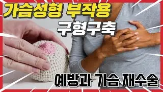 가슴성형 후 구형구축을 예방하고 치료하는 키포인트