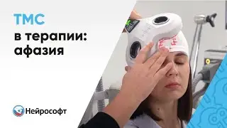 Транскраниальная магнитная стимуляция (ТМС) в терапии: афазия