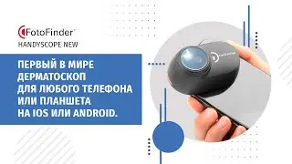 Дерматоскоп handyscope New (DermLite)