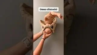 Bebekler nasıl doğar, Doğum nasıl gerçekleşir👶🏻