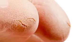 Gorgeous Baby-Feet Device