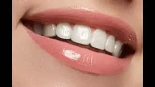Красивейшие в мире зубы.