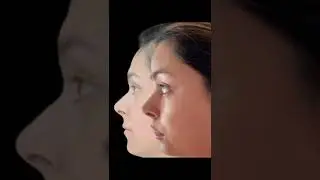 Feminização Facial | Transgender Center Brazil