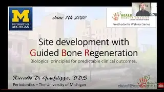Site Development with Guided Bone Regeneration - Dr Riccardo Di Gianfillippo