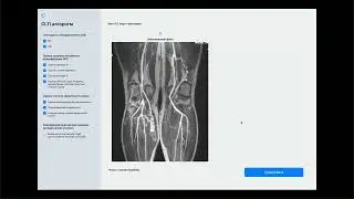 CLTI diagnosis - Демо