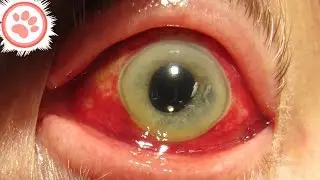 14 Diseases That Science STILL Can't Explain