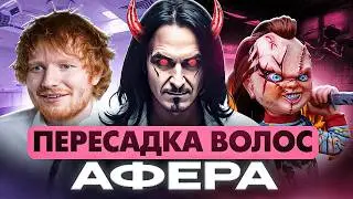 ПЕРЕСАДКА ВОЛОС: ТОТАЛЬНЫЙ РАЗВОД