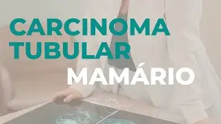 Carcinoma tubular da mama - câncer de mama.