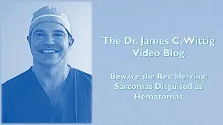 Beware the Red Herring: Sarcomas Disguised as Hematomas
