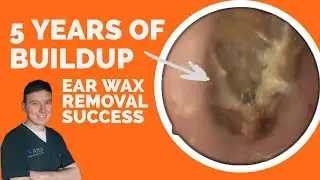 From Frustration to ELATION: Ear Wax Removal Transforms This Man's Hearing Ep.006