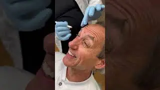 Botox for Dr. Antolak to look younger including a week later - The Gentle Dentists - Shelby Township