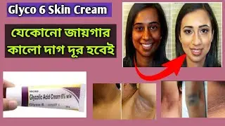 Glyco 6 Skin Cream | যেকোনো কালো দাগ দূর করার সবচেয়ে ভালো ক্রিম | Glycolic Acid 6 % Cream