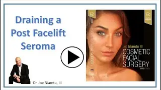 Draining a Post Face Lift Seroma