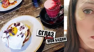 СГЛАЗ или ЧТО ЗНАЧИТ ЕСЛИ ПОДМЫШКИ ЧЕШУТСЯ | ОСТАЛАСЬ НА РАБОТЕ БЕЗ ШТАНОВ