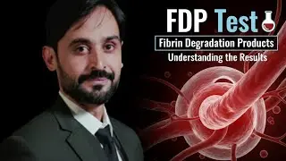 FDP Test | Fibrin Degradation Products Test | MLT Hub with kamran