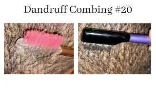 Dandruff combing #20
