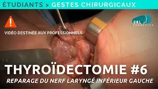 Comment réaliser une thyroïdectomie | #6 Dissection du nerf laryngé | Formation chirurgie ORL