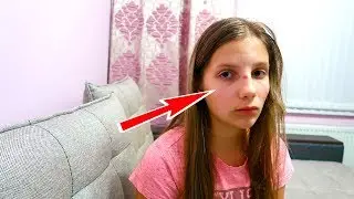 Кто РАЗБИЛ НОС Ирочке?