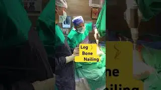 Nailing of Leg bone fracture #tibia #trauma #legsurgery #orthopaedic #raipur #khariarroad